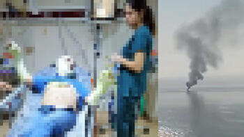 MHP İmamoğlu İlçe Başkanı Savaş Ağca teknede çıkan yangında yaralandı