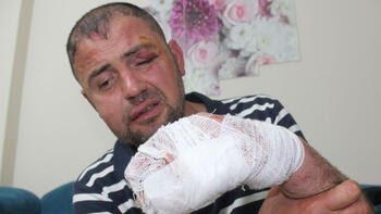 Gemlik’te Dövülen Gazi Askerimize Ülkü Ocakları Sahip Çıktı: Şehir Eşkıyaları Tutuklandı