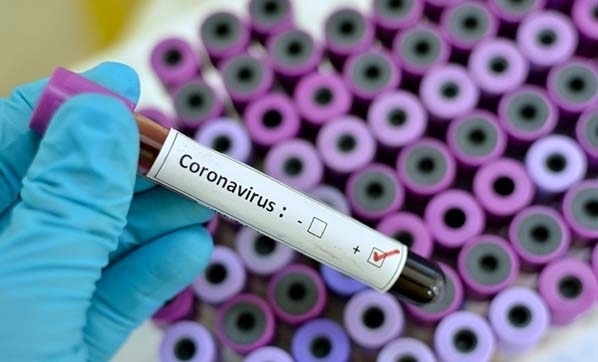 ABD’nin koronavirüs iddiasına Türkiye’den net cevap! #koronawirus