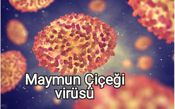 Maymun Çiçeği Virüsü Hastalığı (Monkeypox) nedir, nasıl bulaşır, aşısı var mı, korunma yolları nedir?